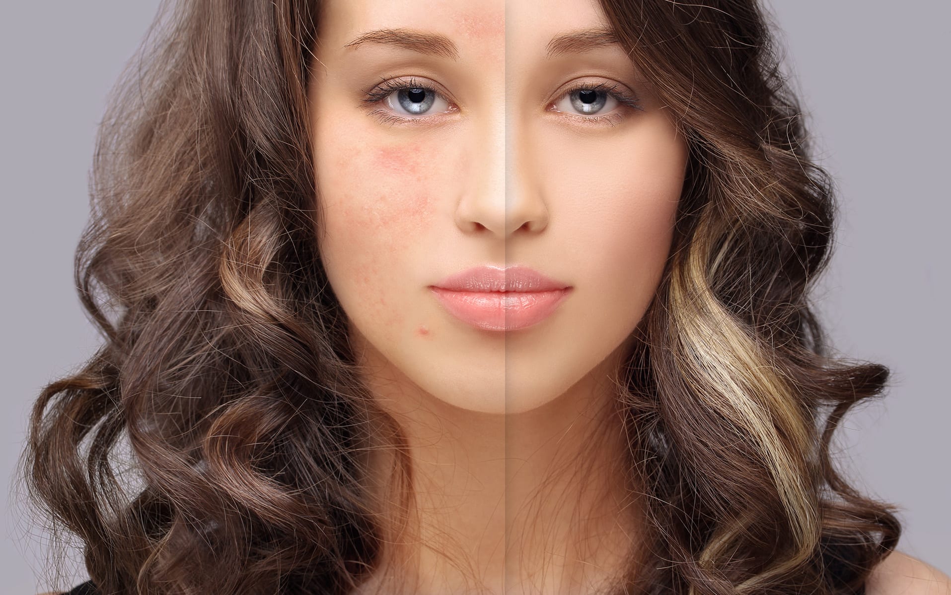 Common Skin Problems and Solutions