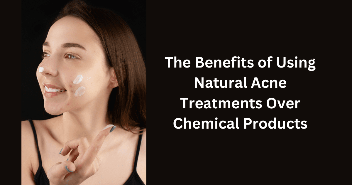 The Benefits of Using Natural Acne Treatments Over Chemical Products